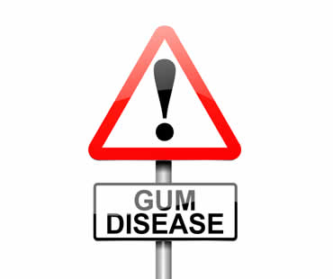 Gum Disease treatment Aventura